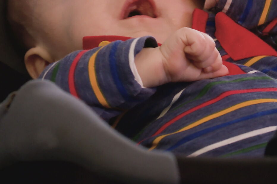 Rodrigo, o 'Bebé sem rosto'