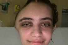 Annabel Sen ficou com o crânio deformado