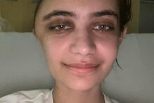 Annabel Sen ficou com o crânio deformado