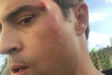 2020-09-26_19_24_59 img_920x519$2020_09_26_19_11_41_1758985.jpg