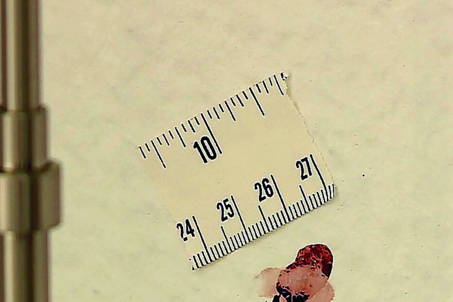 Vestígios de sangue deixados por um dos encapuzados 