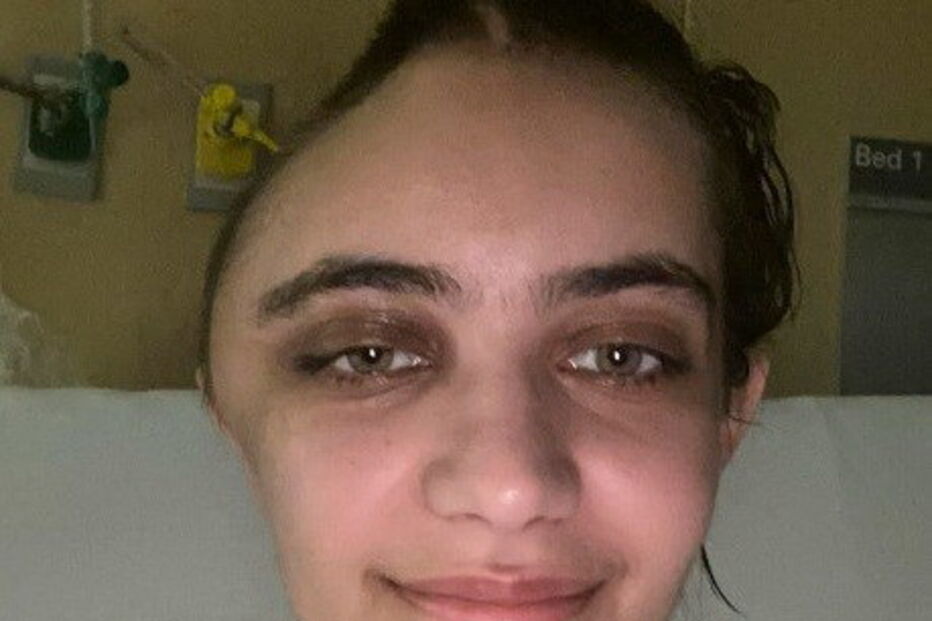 Annabel Sen ficou com o crânio deformado