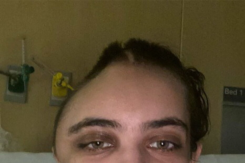 Annabel Sen ficou com o crânio deformado