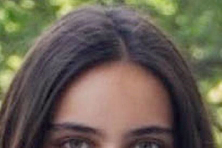 Annabel Sen ficou com o crânio deformado