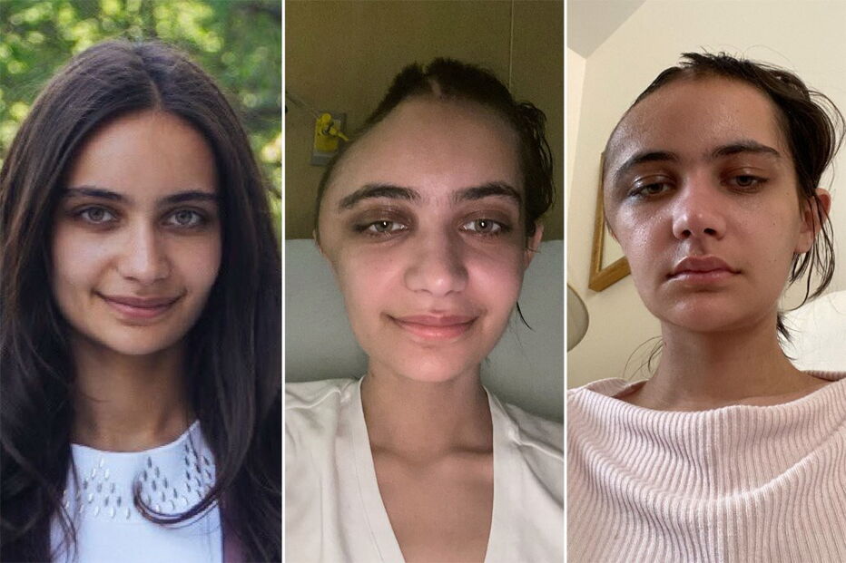 Annabel Sen ficou com o crânio deformado