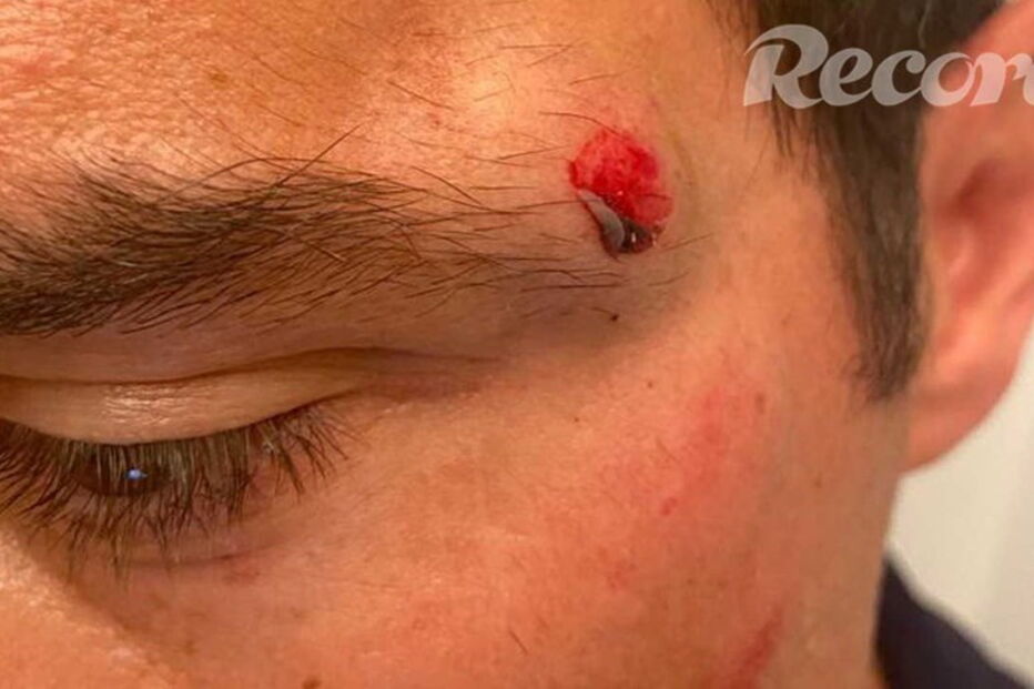 2020-09-26_19_24_59 img_920x519$2020_09_26_19_14_08_1758990.jpg