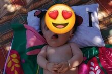 'Bebé sem rosto' faz hoje um ano. Médicos não acreditavam que sobrevivesse