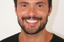 Ator Adriano Toloza faz tratamento para a queda de cabelo