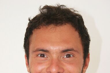 Ator Adriano Toloza faz tratamento para a queda de cabelo