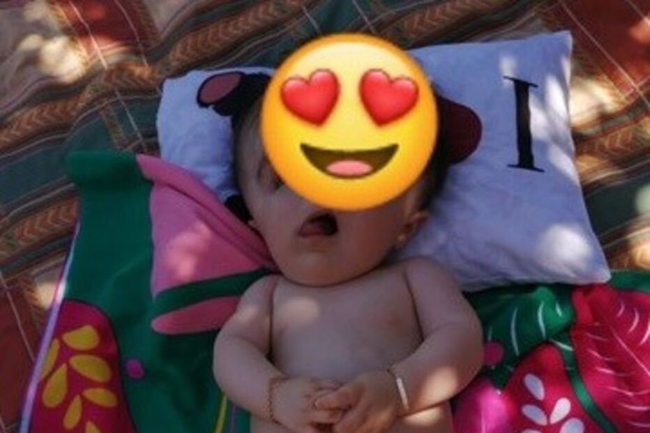 'Bebé sem rosto' faz hoje um ano. Médicos não acreditavam que sobrevivesse