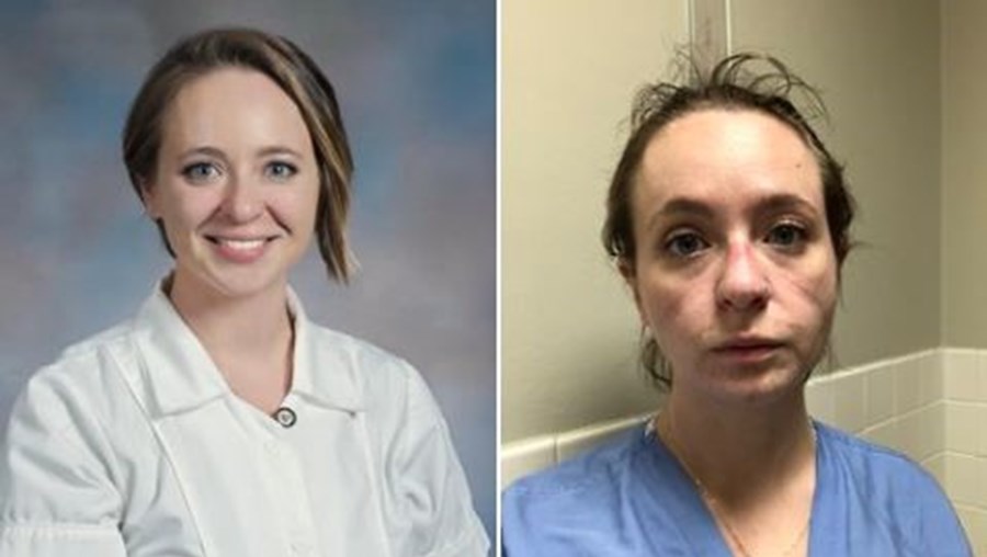 Kathryn é enfermeira nos Estados Unidos e mostra o 'antes e depois' da luta contra a Covid-19