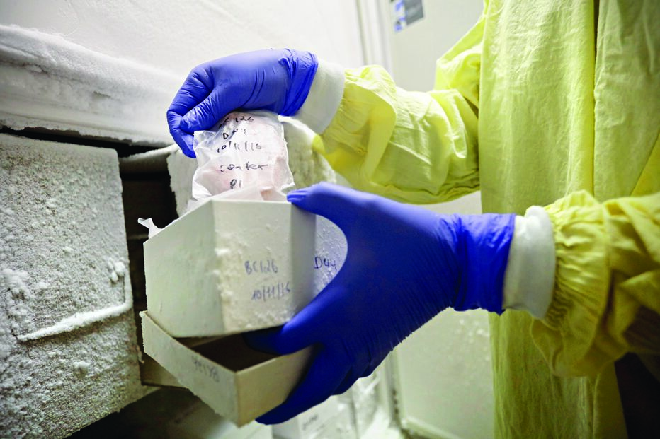 Ricardo Taipa divide um dos cérebros que esteve  conservado em formol. Este exemplar pertenceu a uma mulher que iniciou um quadro de demência aos 70 anos e que viveu com a doença mais 10 anos. O tecido cerebral é dividido em cerca de 40 a 50 áreas de interesse científico. Uma das partes está armazenada em arcas frigoríficas, a 80 graus negativos 