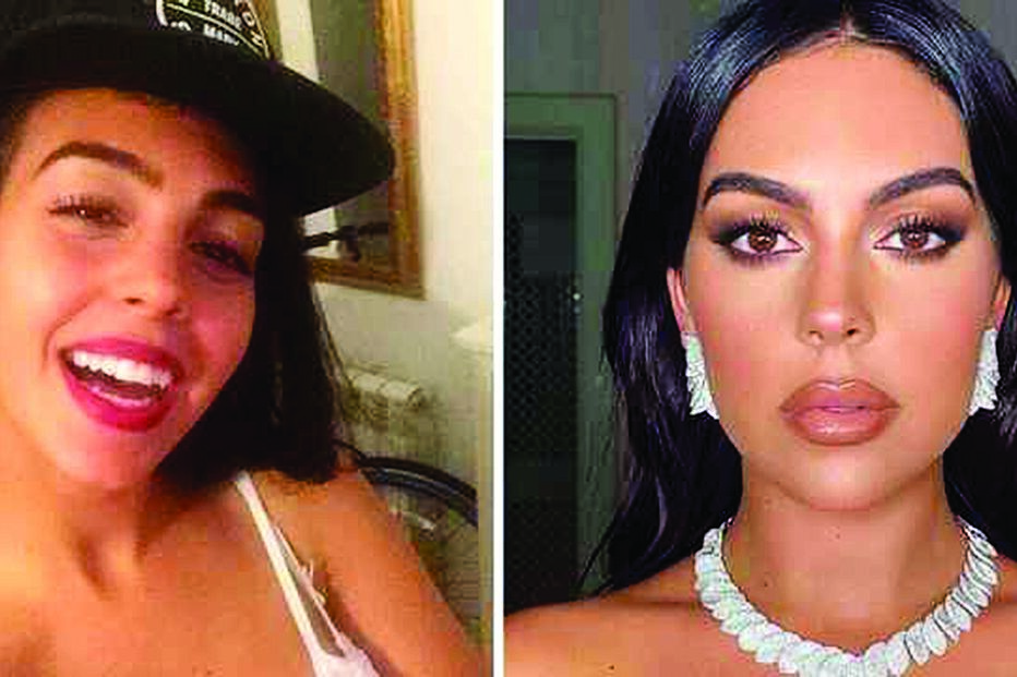 Imagens atuais mostram os resultados dos diversos tratamentos feitos para corrigir a imagem 