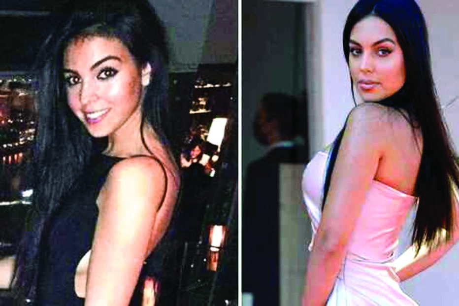 Fotografias antigas revelam como era o rosto da namorada de cr7 antes da cirurgia ao nariz e lábios 