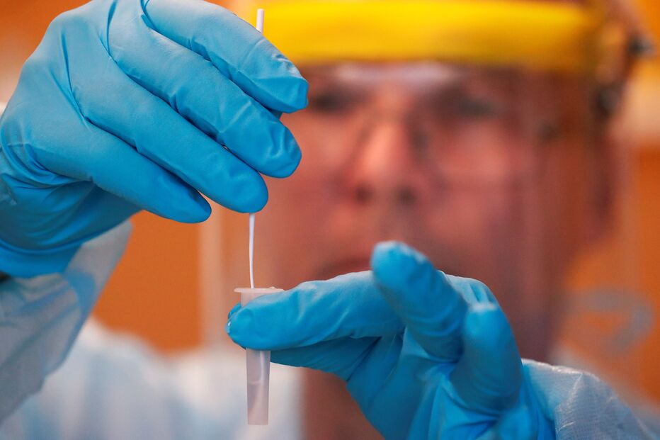 coronavírus, testes, investigadores	