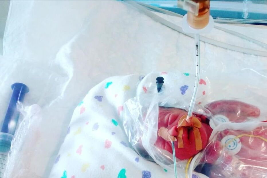 Mãe dá à luz bebé às 26 semanas de gestação em ambulância