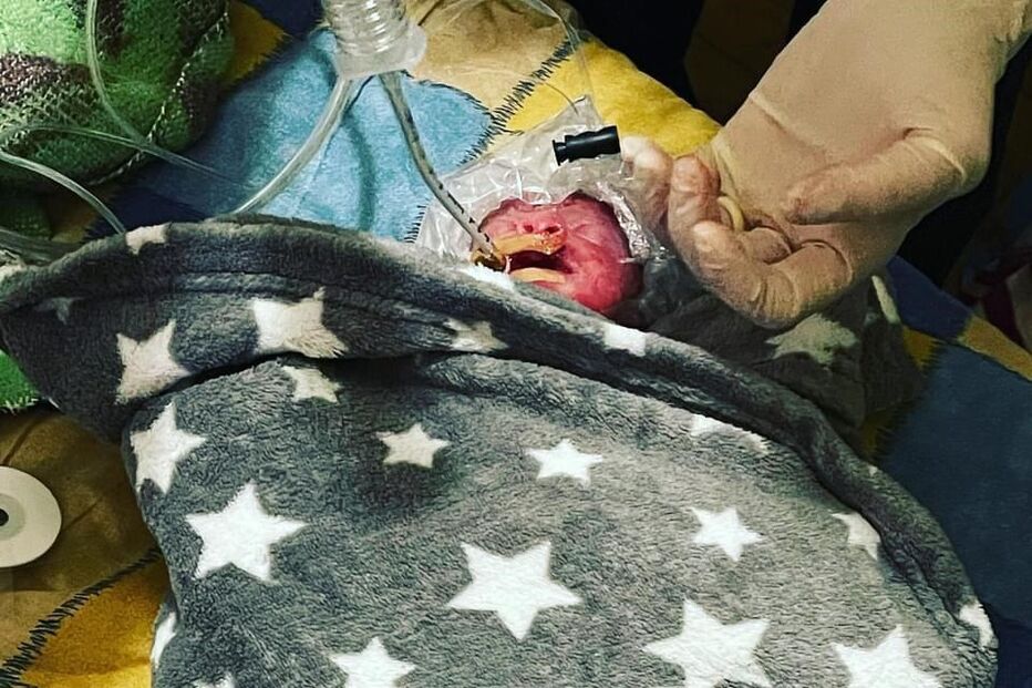 Mãe dá à luz bebé às 26 semanas de gestação em ambulância