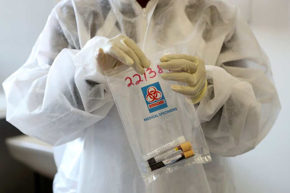 Kit de recolha de amostras para testes à Covid-19