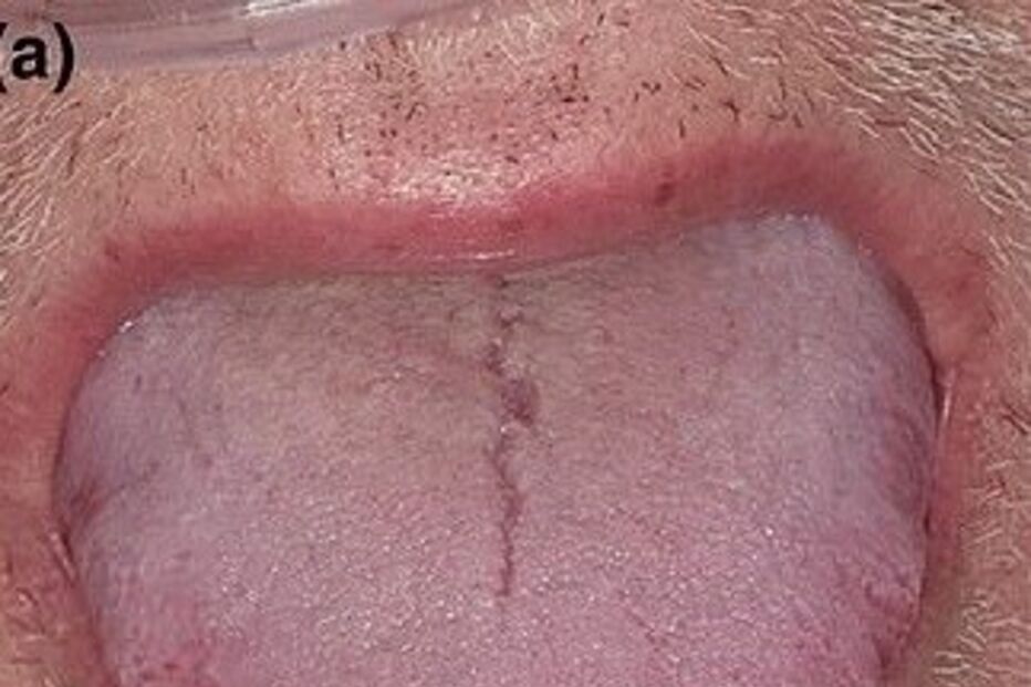 Alterações na boca