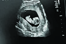 Sara Matos e Pedro Teixeira 