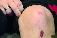 Carla Quintas sofreu ferimentos  