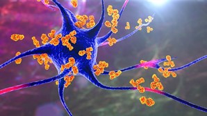 Estudo identifica o vírus que pode ser responsável pela esclerose múltipla