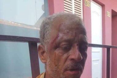 Sequestro e espancamento de bloguer guineense Aly Silva gera indignação nas redes sociais