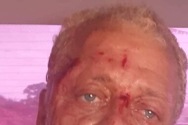 Sequestro e espancamento de bloguer guineense Aly Silva gera indignação nas redes sociais