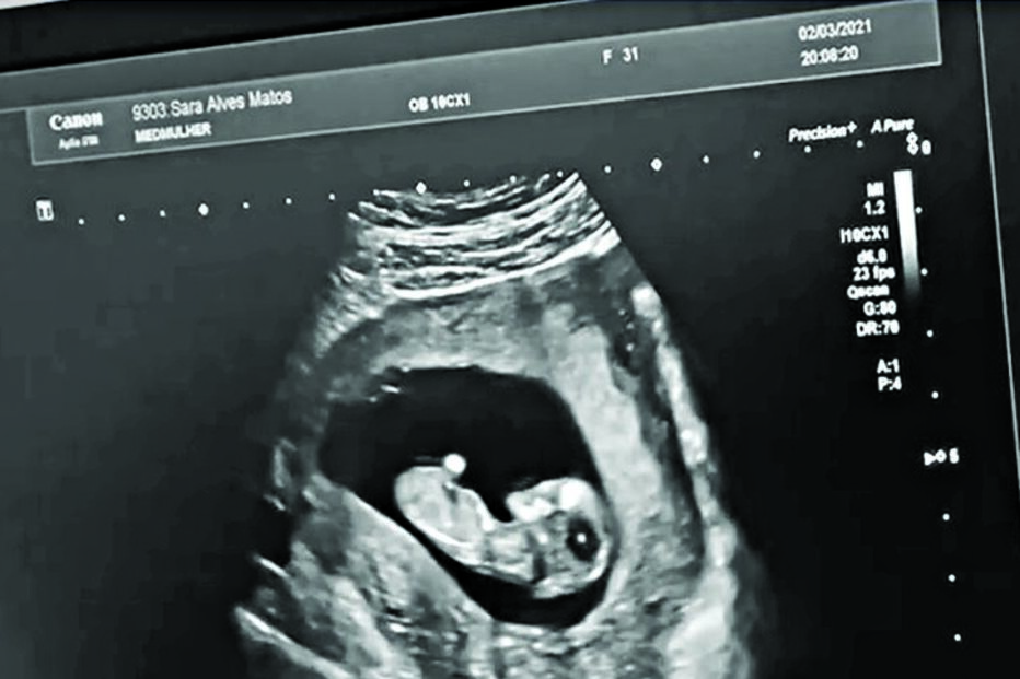 Sara Matos e Pedro Teixeira 