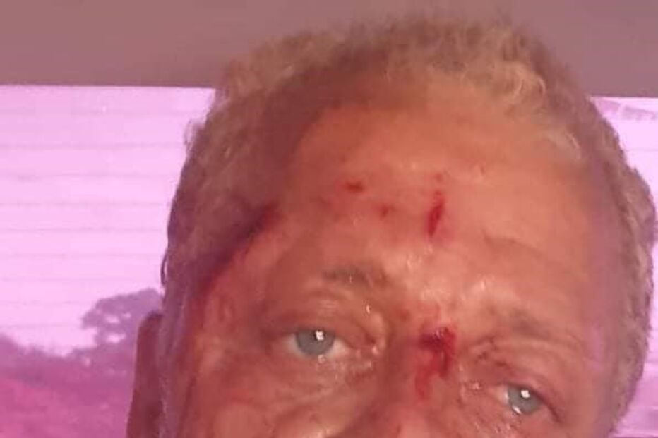 Sequestro e espancamento de bloguer guineense Aly Silva gera indignação nas redes sociais