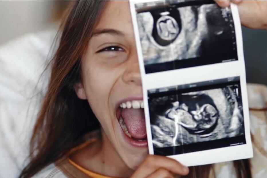 Sara Matos e Pedro Teixeira esperam o primeiro filho em comum