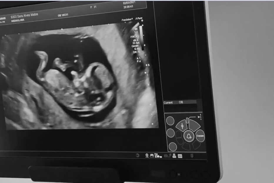 Sara Matos e Pedro Teixeira esperam o primeiro filho em comum