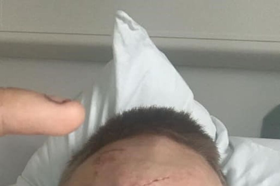 Cobhan McLelland foi atacado