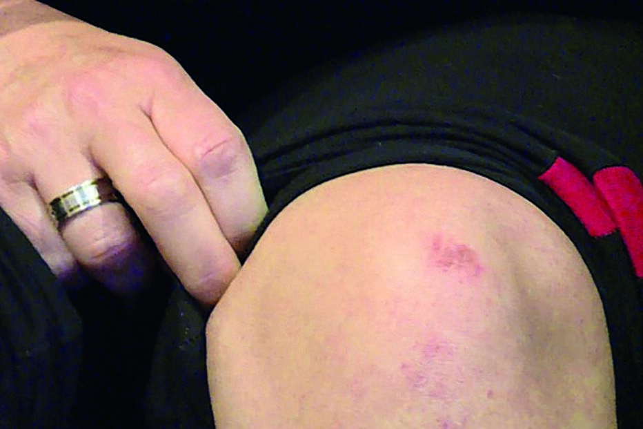 Carla Quintas sofreu ferimentos  