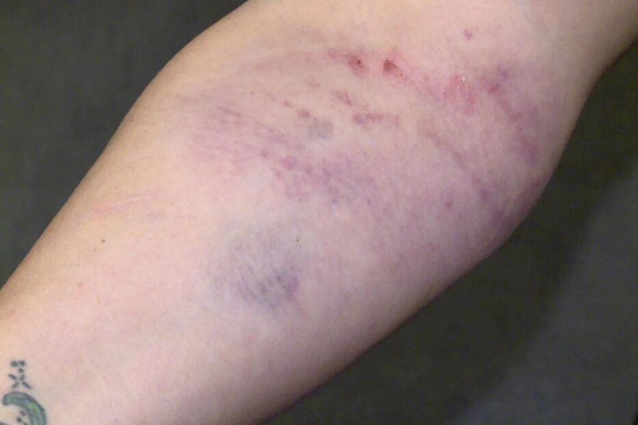 Carla Quintas sofreu ferimentos