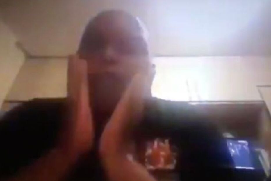 Político mostrou mulher nua acidentalmente