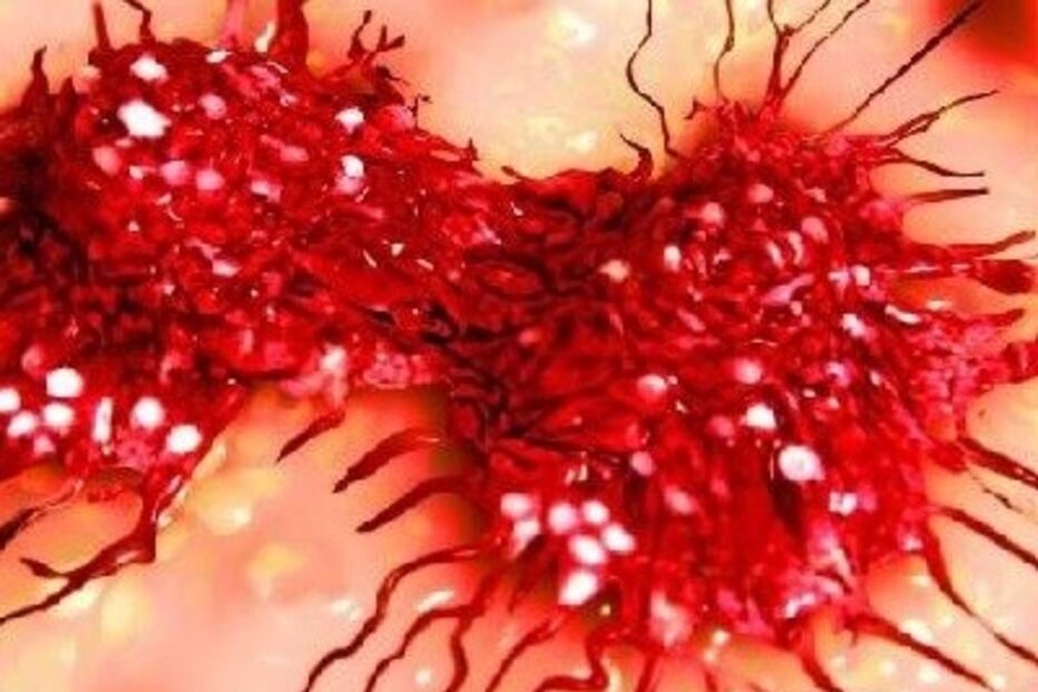 2019-04-08_12_18_59 cancro.jpg