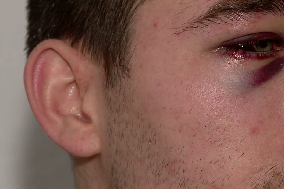 Foi espancado  por dois homens após ter sido iludido por uma rapariga que convidou para casa    