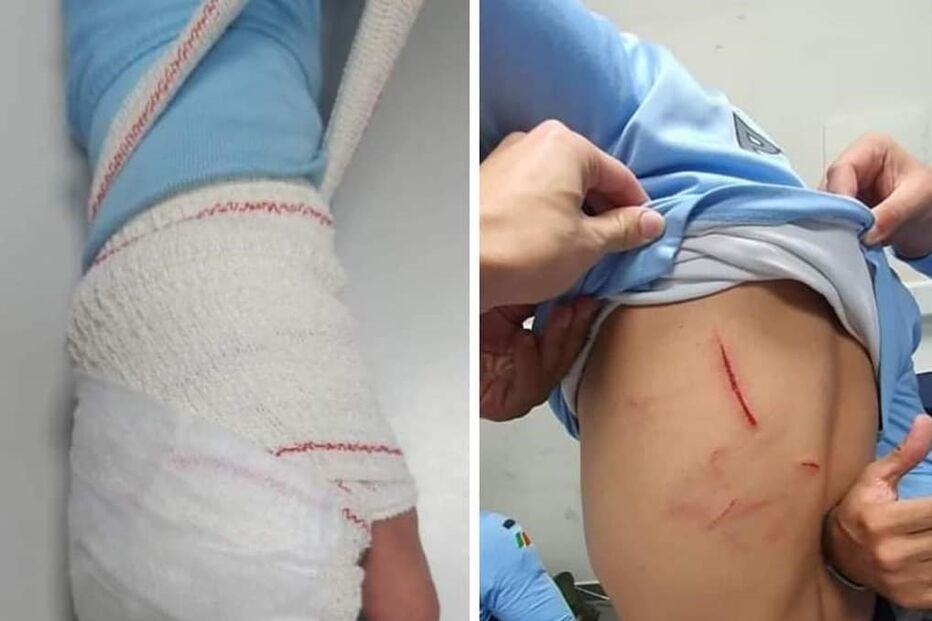 Agressões, polícia, autoridades