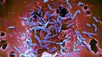 Cientistas de Coimbra descobrem novo mecanismo da infeção pela bactéria Salmonella