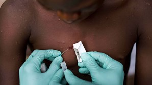 Estados Unidos reportam um caso de infeção pelo vírus Monkeypox