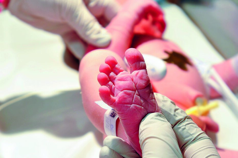 Dados do Instituto Nacional de Saúde Dr. Ricardo Jorge sobre teste do pezinho diferem de registo de nascimentos nos hospitais