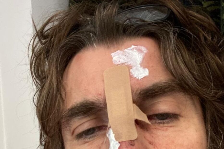  Liam Gallagher