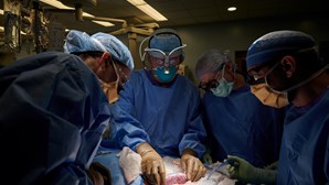 Primeiro transplante de rim de porco em paciente humano realizado com sucesso