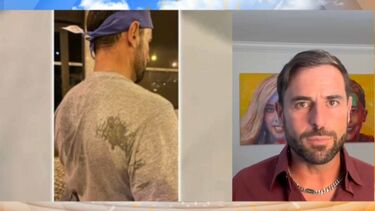Kapinha foi atingido por dois tiros de balas de tinta e esclarece o que se passou 