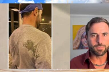 Kapinha foi atingido por dois tiros de balas de tinta e esclarece o que se passou 