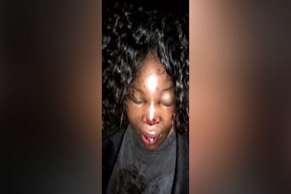 'Sua preta, sua macaca': Polícia está acusado por bater em mulher na Amadora