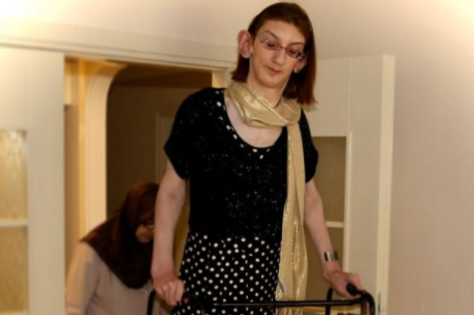 Rumesya Gelgi, a mulher viva mais alta do mundo