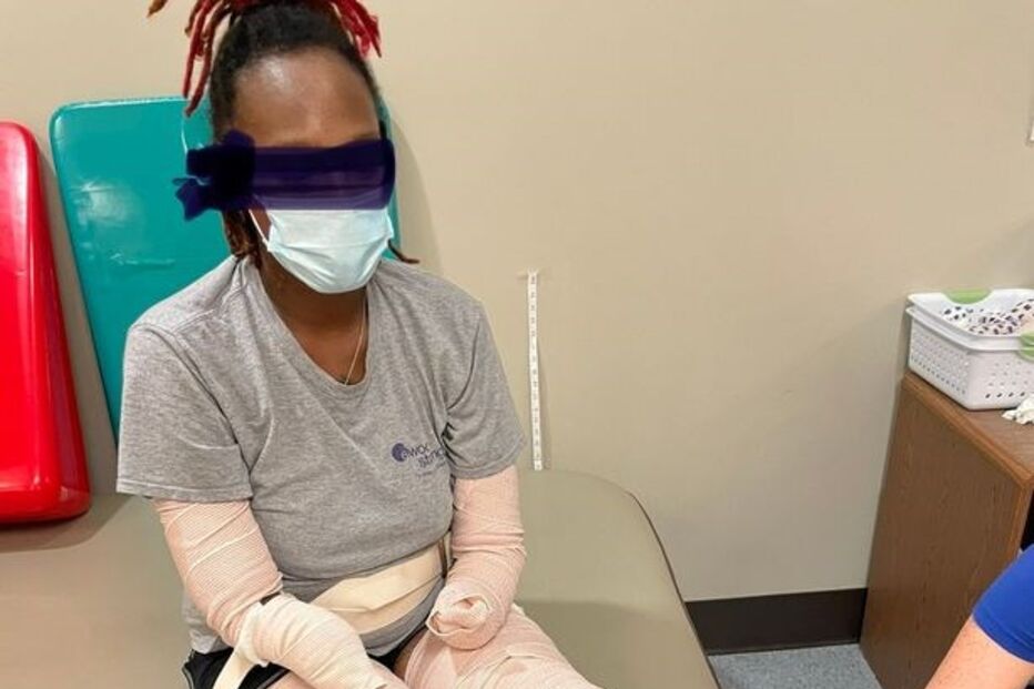 Mulher fica sem pernas e braços devido à Covid-19