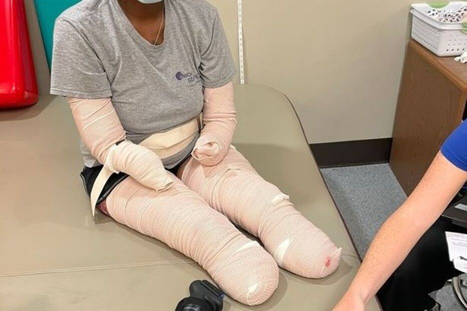 Mulher fica sem pernas e braços devido à Covid-19